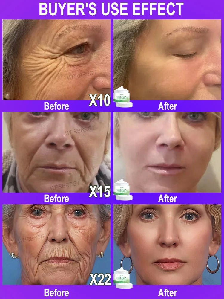 The whole body is smooth without fine lines