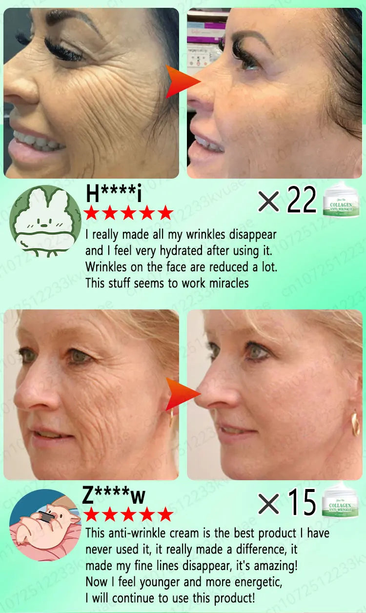The whole body is smooth without fine lines