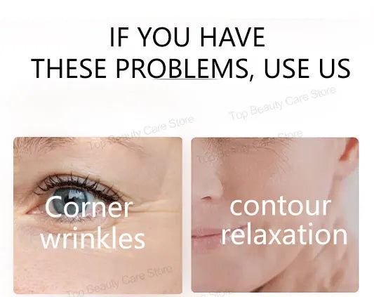 The whole body is smooth without fine lines