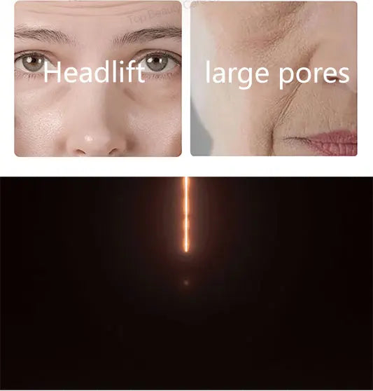 The whole body is smooth without fine lines