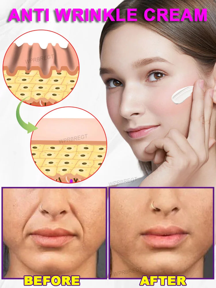 The whole body is smooth without fine lines