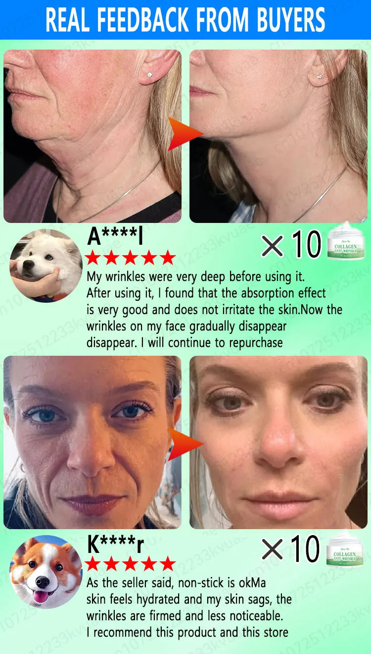 The whole body is smooth without fine lines