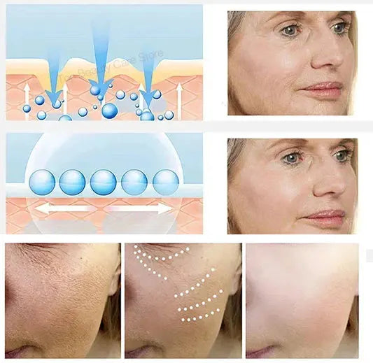 The whole body is smooth without fine lines
