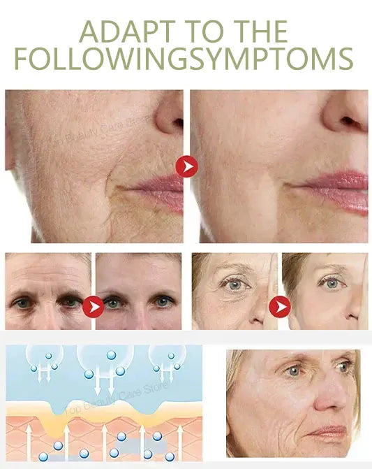 The whole body is smooth without fine lines