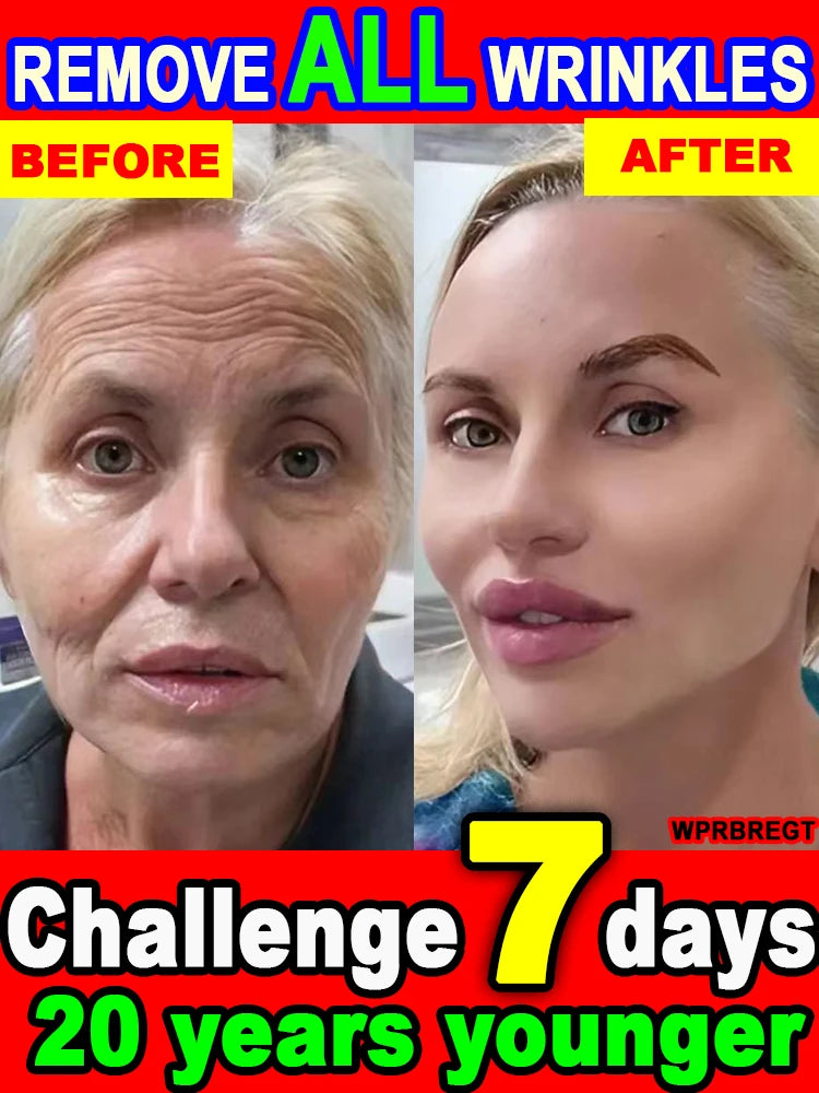 The whole body is smooth without fine lines