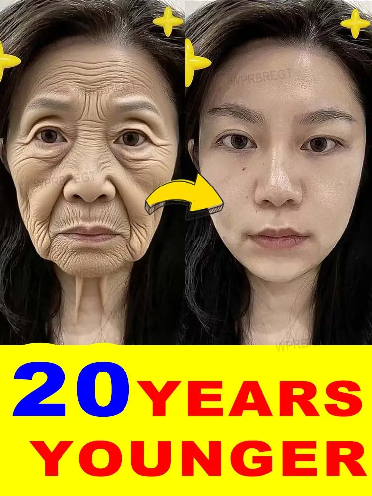 The whole body is smooth without fine lines