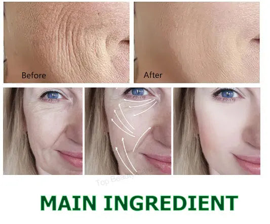 The whole body is smooth without fine lines